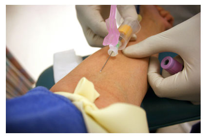 phlebotomy